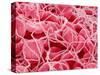 Coagulated Red Blood Cells-Micro Discovery-Stretched Canvas