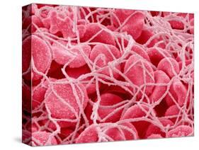 Coagulated Red Blood Cells-Micro Discovery-Stretched Canvas