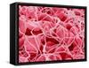 Coagulated Red Blood Cells-Micro Discovery-Framed Stretched Canvas