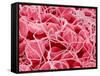 Coagulated Red Blood Cells-Micro Discovery-Framed Stretched Canvas