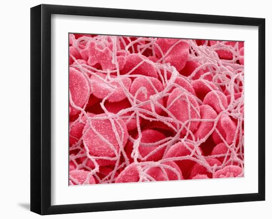 Coagulated Red Blood Cells-Micro Discovery-Framed Premium Photographic Print