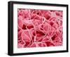 Coagulated Red Blood Cells-Micro Discovery-Framed Premium Photographic Print