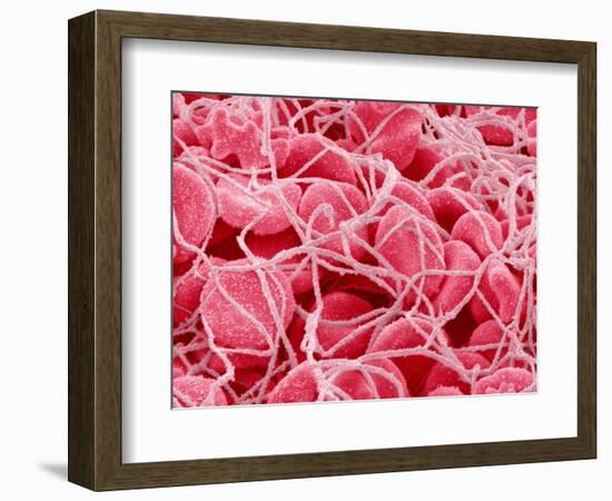 Coagulated Red Blood Cells-Micro Discovery-Framed Photographic Print