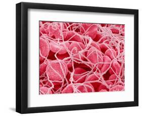 Coagulated Red Blood Cells-Micro Discovery-Framed Photographic Print