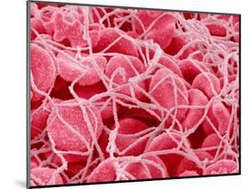 Coagulated Red Blood Cells-Micro Discovery-Mounted Photographic Print