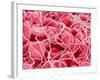 Coagulated Red Blood Cells-Micro Discovery-Framed Photographic Print