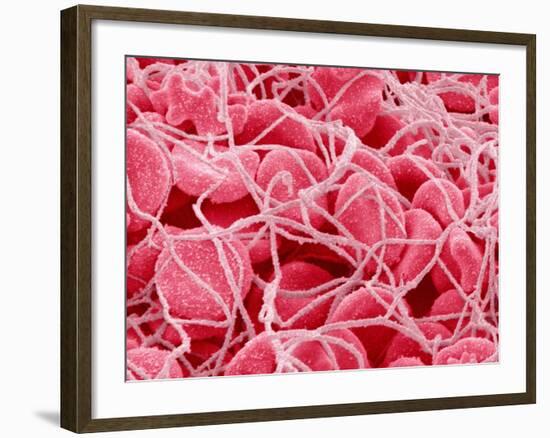 Coagulated Red Blood Cells-Micro Discovery-Framed Photographic Print