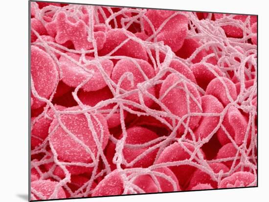Coagulated Red Blood Cells-Micro Discovery-Mounted Photographic Print