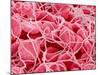 Coagulated Red Blood Cells-Micro Discovery-Mounted Photographic Print