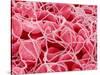 Coagulated Red Blood Cells-Micro Discovery-Stretched Canvas