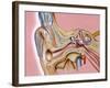 Cochlear Implant, Artwork-John Bavosi-Framed Photographic Print
