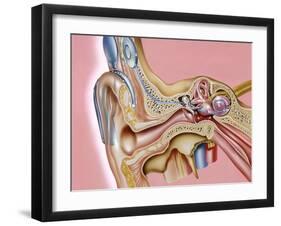 Cochlear Implant, Artwork-John Bavosi-Framed Photographic Print