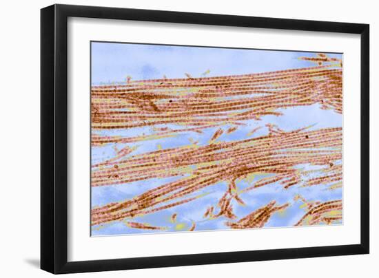 Collagen Fibres, TEM-Thomas Deerinck-Framed Photographic Print