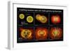 Colliding Neutron Stars Create Black Hole and Gamma-ray Burst-Science Source-Framed Giclee Print