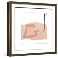 Colonoscopy, Artwork-Peter Gardiner-Framed Photographic Print