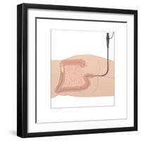 Colonoscopy, Artwork-Peter Gardiner-Framed Photographic Print