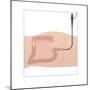 Colonoscopy, Artwork-Peter Gardiner-Mounted Photographic Print