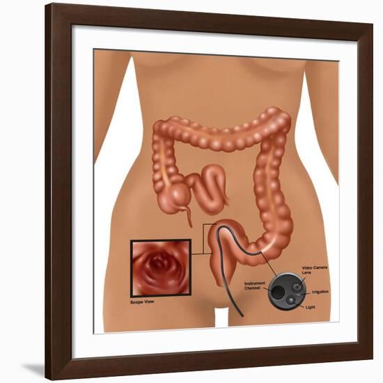 Colonoscopy-Gwen Shockey-Framed Giclee Print