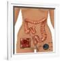 Colonoscopy-Gwen Shockey-Framed Giclee Print