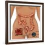 Colonoscopy-Gwen Shockey-Framed Giclee Print