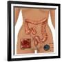 Colonoscopy-Gwen Shockey-Framed Giclee Print