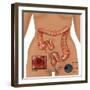 Colonoscopy-Gwen Shockey-Framed Giclee Print