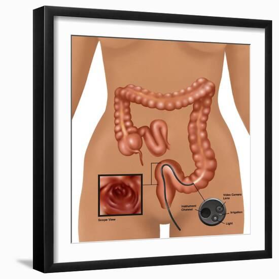 Colonoscopy-Gwen Shockey-Framed Giclee Print