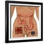 Colonoscopy-Gwen Shockey-Framed Premium Giclee Print