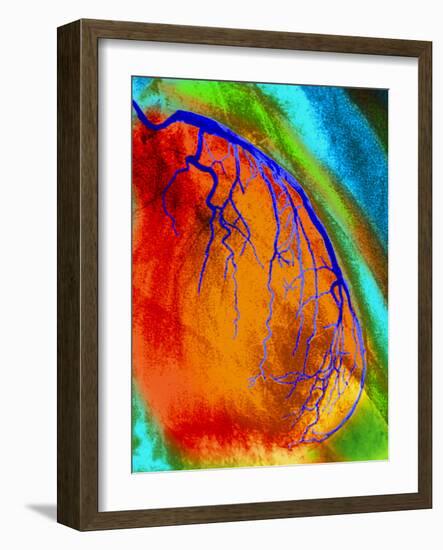 Coloured Angiogram of Coronary Artery of the Heart-Science Photo Library-Framed Photographic Print