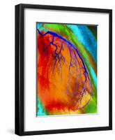 Coloured Angiogram of Coronary Artery of the Heart-Science Photo Library-Framed Photographic Print