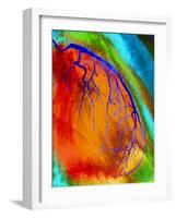 Coloured Angiogram of Coronary Artery of the Heart-Science Photo Library-Framed Photographic Print