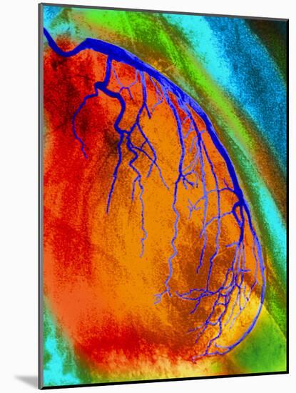 Coloured Angiogram of Coronary Artery of the Heart-Science Photo Library-Mounted Photographic Print