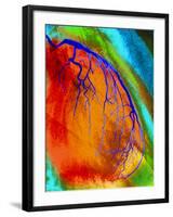 Coloured Angiogram of Coronary Artery of the Heart-Science Photo Library-Framed Photographic Print