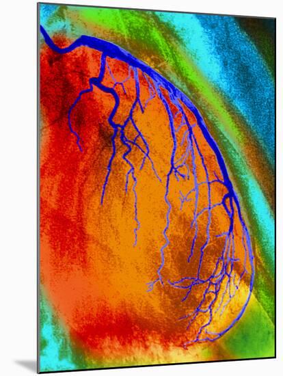 Coloured Angiogram of Coronary Artery of the Heart-Science Photo Library-Mounted Photographic Print