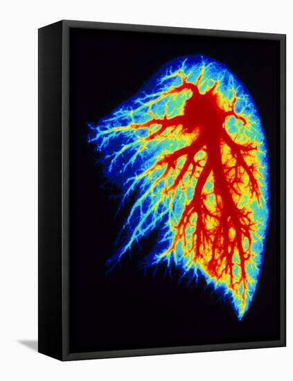 Coloured Angiogram of Pulmonary Arteries of Lung-Science Photo Library-Framed Stretched Canvas