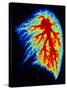 Coloured Angiogram of Pulmonary Arteries of Lung-Science Photo Library-Stretched Canvas