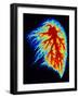 Coloured Angiogram of Pulmonary Arteries of Lung-Science Photo Library-Framed Photographic Print