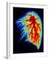 Coloured Angiogram of Pulmonary Arteries of Lung-Science Photo Library-Framed Photographic Print