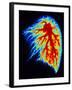 Coloured Angiogram of Pulmonary Arteries of Lung-Science Photo Library-Framed Photographic Print