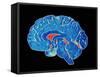 Coloured CT Scan of a Healthy Brain (side View)-PASIEKA-Framed Stretched Canvas