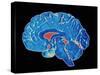 Coloured CT Scan of a Healthy Brain (side View)-PASIEKA-Stretched Canvas