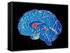 Coloured CT Scan of a Healthy Brain (side View)-PASIEKA-Framed Stretched Canvas