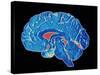 Coloured CT Scan of a Healthy Brain (side View)-PASIEKA-Stretched Canvas