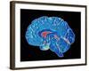 Coloured CT Scan of a Healthy Brain (side View)-PASIEKA-Framed Photographic Print