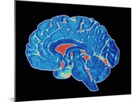 Coloured CT Scan of a Healthy Brain (side View)-PASIEKA-Mounted Photographic Print