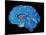Coloured CT Scan of a Healthy Brain (side View)-PASIEKA-Mounted Photographic Print