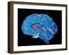 Coloured CT Scan of a Healthy Brain (side View)-PASIEKA-Framed Photographic Print