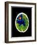 Coloured CT Scan of Brain Abscess In AIDS Patient-Science Photo Library-Framed Premium Photographic Print