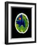 Coloured CT Scan of Brain Abscess In AIDS Patient-Science Photo Library-Framed Premium Photographic Print