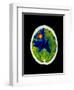 Coloured CT Scan of Brain Abscess In AIDS Patient-Science Photo Library-Framed Premium Photographic Print